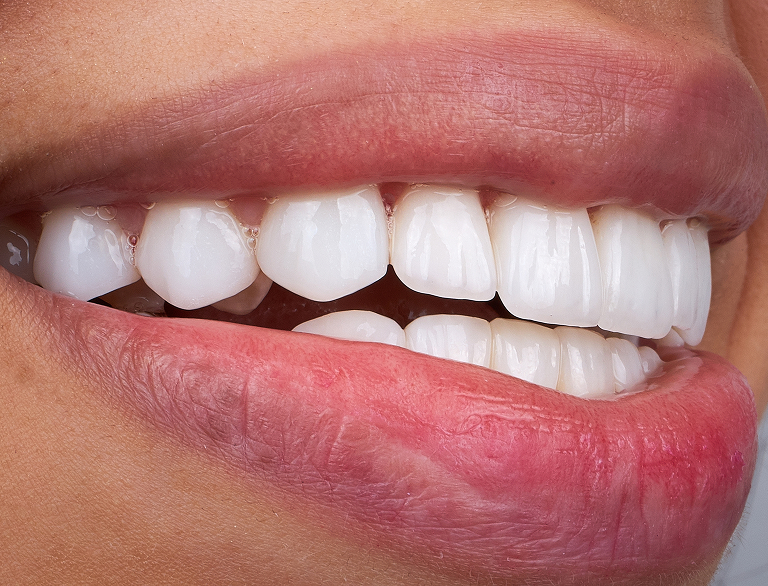 Repair and Refresh Your Smile with Ease