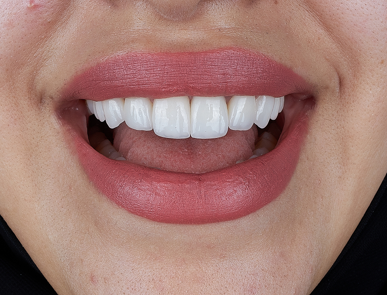 Advanced Materials for Lasting Results