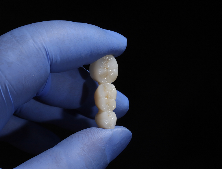 Restore Your Smile with a Lasting Solution