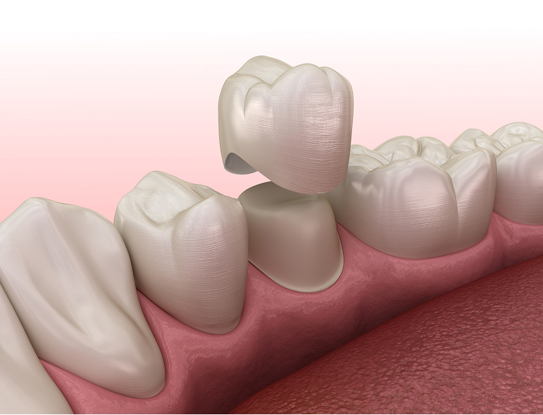 Strengthen and Protect Your Smile