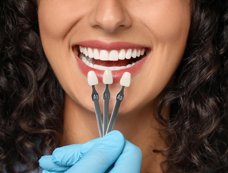 Transform Your Smile with Lasting Confidence