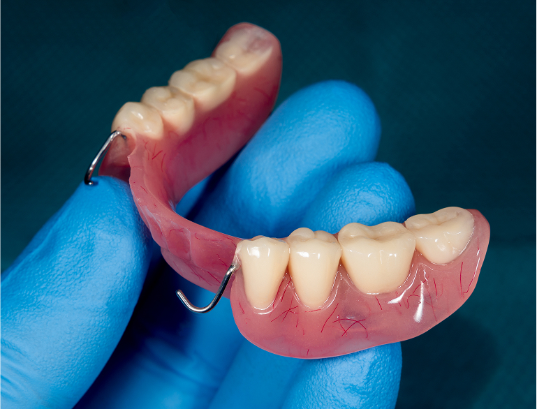 Benefits of Dentures and Partials