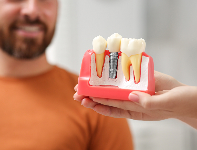 Healing and Osseointegration